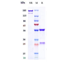 SDS-PAGE - Galiximab Biosimilar - Anti-CD80 Antibody - Low endotoxin, Azide free (A323466) - Antibodies.com