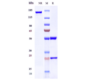 SDS-PAGE - Gantenerumab Biosimilar - Anti-beta Amyloid Antibody - Low endotoxin, Azide free (A323469) - Antibodies.com