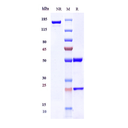 SDS-PAGE - Gantenerumab Biosimilar - Anti-beta Amyloid Antibody - Low endotoxin, Azide free (A323469) - Antibodies.com