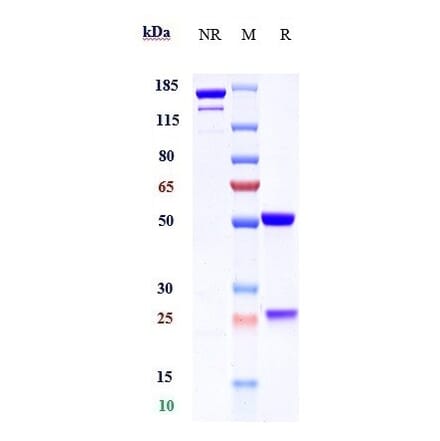 SDS-PAGE - Garadacimab Biosimilar - Anti-Factor XII Antibody - Low endotoxin, Azide free (A323470) - Antibodies.com