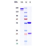 SDS-PAGE - Garadacimab Biosimilar - Anti-Factor XII Antibody - Low endotoxin, Azide free (A323470) - Antibodies.com