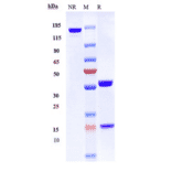 SDS-PAGE - Gatipotuzumab Biosimilar - Anti-MUC1 Antibody - Low endotoxin, Azide free (A323473) - Antibodies.com