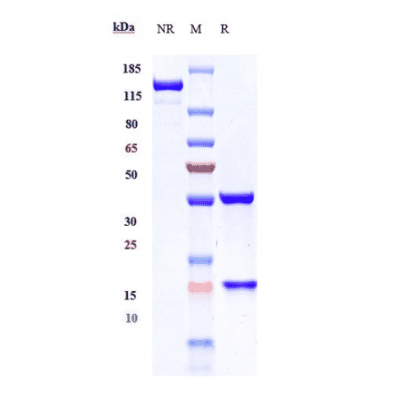 SDS-PAGE - Gevokizumab Biosimilar - Anti-IL-1 beta Antibody - Low endotoxin, Azide free (A323478) - Antibodies.com