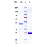 SDS-PAGE - Glenzocimab Biosimilar - Anti-GPVI Antibody - Low endotoxin, Azide free (A323485) - Antibodies.com