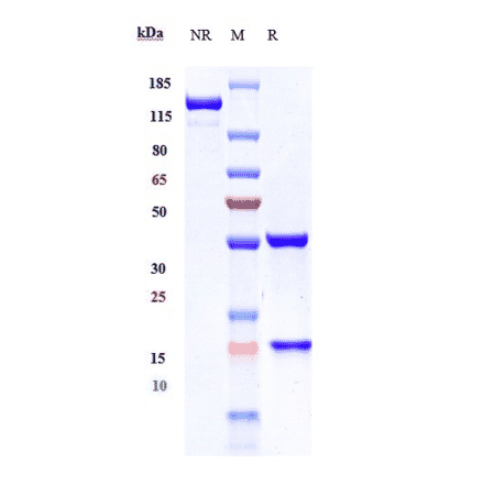 SDS-PAGE - Ibritumomab Biosimilar - Anti-CD20 Antibody - Low endotoxin, Azide free (A323493) - Antibodies.com