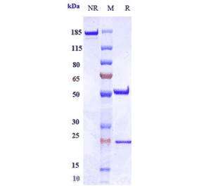 SDS-PAGE - Ieramilimab Biosimilar - Anti-LAG-3 Antibody - Low endotoxin, Azide free (A323497) - Antibodies.com