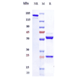 SDS-PAGE - Ifabotuzumab Biosimilar - Anti-Eph Receptor A3 Antibody - Low endotoxin, Azide free (A323498) - Antibodies.com