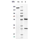 SDS-PAGE - Iladatuzumab Biosimilar - Anti-CD79b Antibody - Low endotoxin, Azide free (A323500) - Antibodies.com