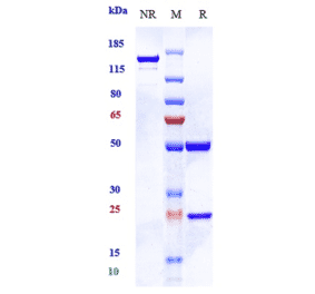 SDS-PAGE - Imaprelimab Biosimilar - Anti-CD146 Antibody - Low endotoxin, Azide free (A323502) - Antibodies.com