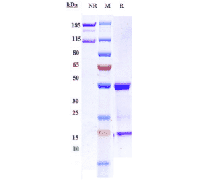 SDS-PAGE - Imgatuzumab Biosimilar - Anti-EGFR Antibody - Low endotoxin, Azide free (A323503) - Antibodies.com