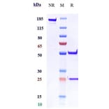 SDS-PAGE - Imsidolimab Biosimilar - Anti-IL-36R Antibody - Low endotoxin, Azide free (A323504) - Antibodies.com