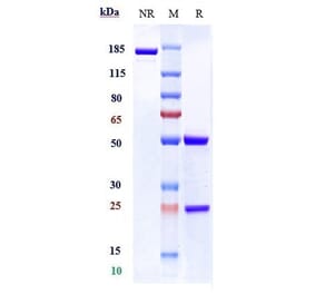SDS-PAGE - Inclacumab Biosimilar - Anti-CD62P Antibody - Low endotoxin, Azide free (A323505) - Antibodies.com