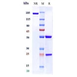 SDS-PAGE - Inclacumab Biosimilar - Anti-CD62P Antibody - Low endotoxin, Azide free (A323505) - Antibodies.com