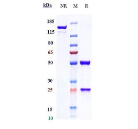 SDS-PAGE - Indusatumab Biosimilar - Anti-GC-C Antibody - Low endotoxin, Azide free (A323508) - Antibodies.com