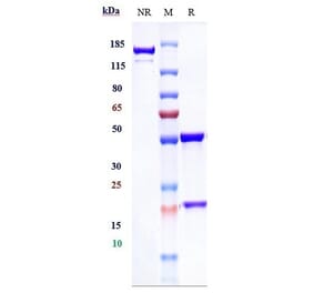 SDS-PAGE - Infliximab Biosimilar - Anti-TNF alpha Antibody - Low endotoxin, Azide free (A323510) - Antibodies.com