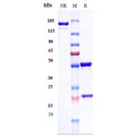 SDS-PAGE - Infliximab Biosimilar - Anti-TNF alpha Antibody - Low endotoxin, Azide free (A323510) - Antibodies.com