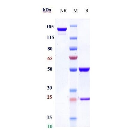 SDS-PAGE - Inotuzumab Biosimilar - Anti-CD22 Antibody - Low endotoxin, Azide free (A323512) - Antibodies.com