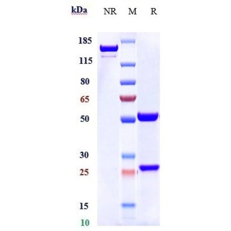 SDS-PAGE - Itolizumab Biosimilar - Anti-CD6/T12 Antibody - Low endotoxin, Azide free (A323520) - Antibodies.com