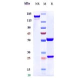 SDS-PAGE - Itolizumab Biosimilar - Anti-CD6/T12 Antibody - Low endotoxin, Azide free (A323520) - Antibodies.com