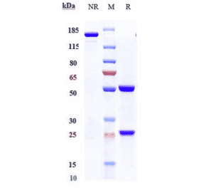 SDS-PAGE - Ixekizumab Biosimilar - Anti-IL-17A Antibody - Low endotoxin, Azide free (A323522) - Antibodies.com