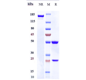 SDS-PAGE - Lacnotuzumab Biosimilar - Anti-M-CSF Antibody - Low endotoxin, Azide free (A323525) - Antibodies.com