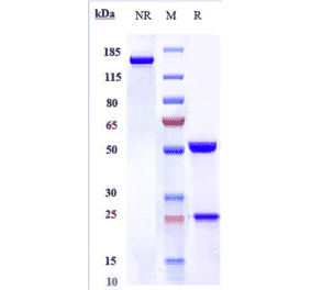 SDS-PAGE - Lacutamab Biosimilar - Anti-KIR3DL2 Antibody - Low endotoxin, Azide free (A323526) - Antibodies.com