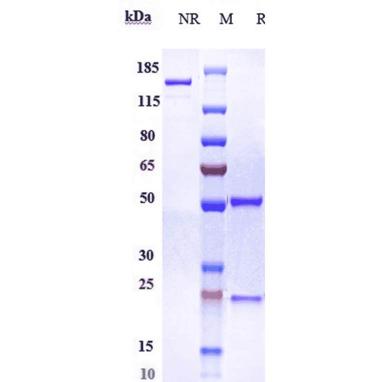 SDS-PAGE - Lampalizumab Biosimilar - Anti-Factor D/CFD Antibody - Low endotoxin, Azide free (A323529) - Antibodies.com