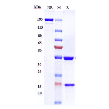 SDS-PAGE - Laprituximab Biosimilar - Anti-EGFR Antibody - Low endotoxin, Azide free (A323532) - Antibodies.com