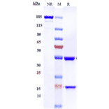 SDS-PAGE - Laprituximab Biosimilar - Anti-EGFR Antibody - Low endotoxin, Azide free (A323532) - Antibodies.com