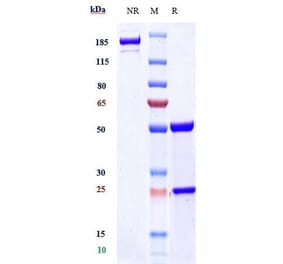SDS-PAGE - Lecanemab Biosimilar - Anti-beta Amyloid Antibody - Low endotoxin, Azide free (A323535) - Antibodies.com