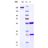 SDS-PAGE - Lecanemab Biosimilar - Anti-beta Amyloid Antibody - Low endotoxin, Azide free (A323535) - Antibodies.com