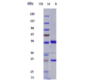 SDS-PAGE - Lemzoparlimab Biosimilar - Anti-CD47 Antibody - Low endotoxin, Azide free (A323536) - Antibodies.com