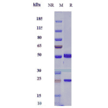 SDS-PAGE - Lemzoparlimab Biosimilar - Anti-CD47 Antibody - Low endotoxin, Azide free (A323536) - Antibodies.com