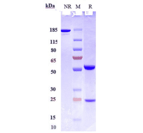 SDS-PAGE - Lenzilumab Biosimilar - Anti-GM-CSF Antibody - Low endotoxin, Azide free (A323538) - Antibodies.com