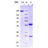 SDS-PAGE - Lenzilumab Biosimilar - Anti-GM-CSF Antibody - Low endotoxin, Azide free (A323538) - Antibodies.com