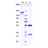 SDS-PAGE - Lexatumumab Biosimilar - Anti-DR5 Antibody - Low endotoxin, Azide free (A323542) - Antibodies.com
