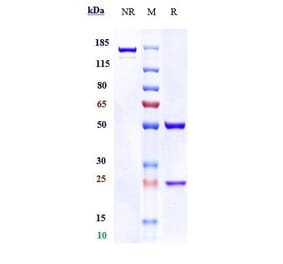SDS-PAGE - Lifastuzumab Biosimilar - Anti-SLC34A2 Antibody - Low endotoxin, Azide free (A323544) - Antibodies.com