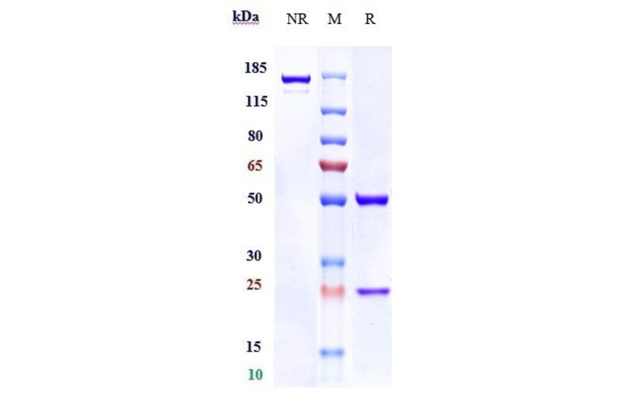 SDS-PAGE - Lifastuzumab Biosimilar - Anti-SLC34A2 Antibody - Low endotoxin, Azide free (A323544) - Antibodies.com