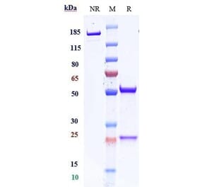 SDS-PAGE - Ligufalimab Biosimilar - Anti-CD47 Antibody - Low endotoxin, Azide free (A323546) - Antibodies.com