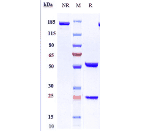 SDS-PAGE - Lirilumab Biosimilar - Anti-KIR3DL1 Antibody - Low endotoxin, Azide free (A323551) - Antibodies.com