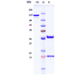 SDS-PAGE - Lodelcizumab Biosimilar - Anti-PCSK9 Antibody - Low endotoxin, Azide free (A323553) - Antibodies.com