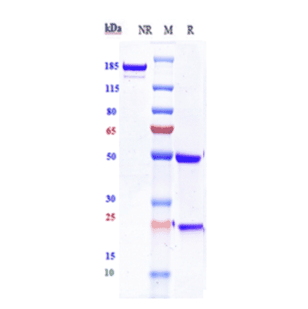 SDS-PAGE - Loncastuximab Biosimilar - Anti-CD19 Antibody - Low endotoxin, Azide free (A323555) - Antibodies.com