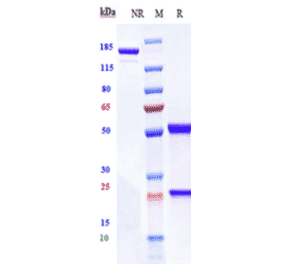 SDS-PAGE - Lonigutamab Biosimilar - Anti-IGF1 Receptor Antibody - Low endotoxin, Azide free (A323556) - Antibodies.com