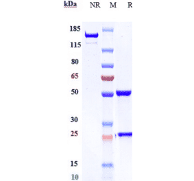 SDS-PAGE - Lorvotuzumab Biosimilar - Anti-NCAM1 Antibody - Low endotoxin, Azide free (A323559) - Antibodies.com