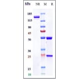 SDS-PAGE - Lucatumumab Biosimilar - Anti-CD40 Antibody - Low endotoxin, Azide free (A323561) - Antibodies.com