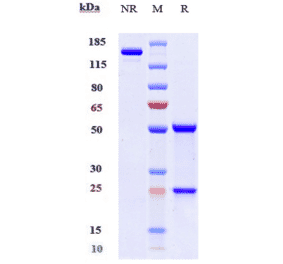 SDS-PAGE - Mavrilimumab Biosimilar - Anti-CD116 Antibody - Low endotoxin, Azide free (A323573) - Antibodies.com