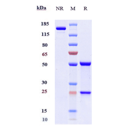 SDS-PAGE - Mavrilimumab Biosimilar - Anti-CD116 Antibody - Low endotoxin, Azide free (A323573) - Antibodies.com