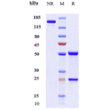 SDS-PAGE - Mavrilimumab Biosimilar - Anti-CD116 Antibody - Low endotoxin, Azide free (A323573) - Antibodies.com