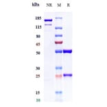 SDS-PAGE - Mezagitamab Biosimilar - Anti-CD38 Antibody - Low endotoxin, Azide free (A323576) - Antibodies.com