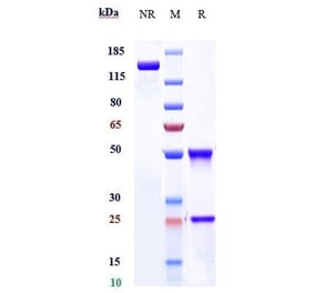 SDS-PAGE - Mibavademab Biosimilar - Anti-Leptin Receptor Antibody - Low endotoxin, Azide free (A323577) - Antibodies.com